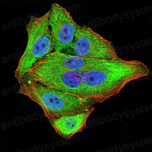 Валидация IF - AntibodySystem RHC23401