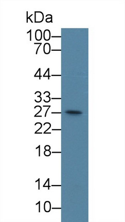 9395