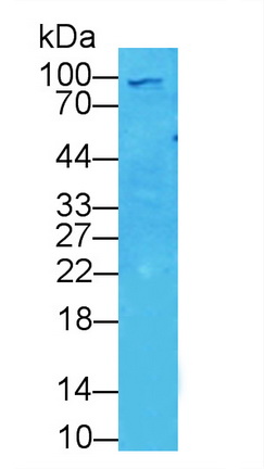 11910