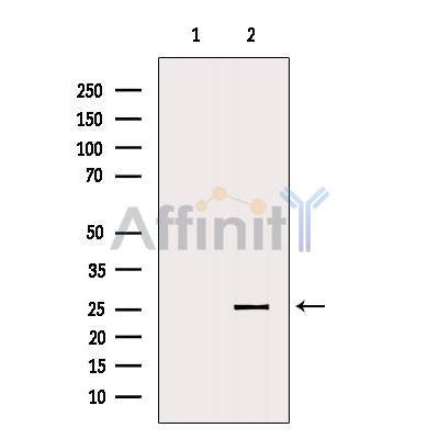 Валидация Affinity AF5126 - 2499