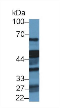 14491