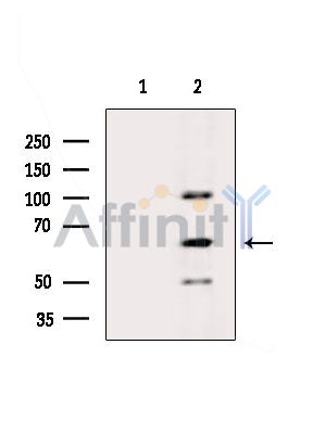 Валидация Affinity DF13863 - 9579