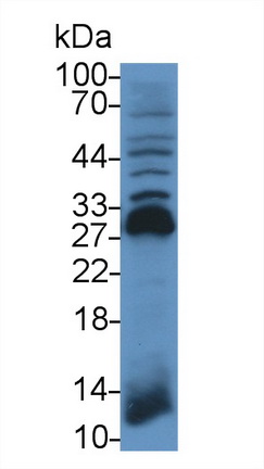 14615