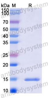 Валидация SDS-PAGE - AntibodySystem RWN10304