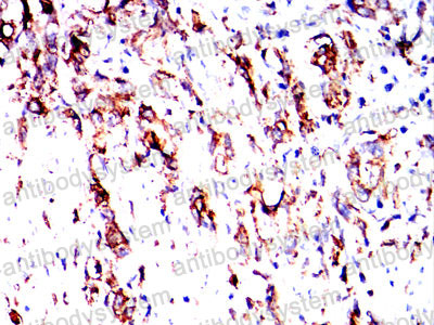 Валидация AntibodySystem RHM01801 (3774)