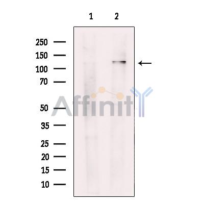 Валидация Affinity DF9314 - 21779