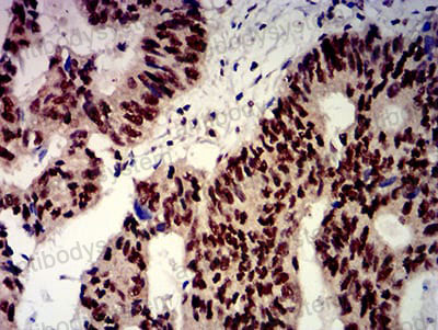 Валидация AntibodySystem RHN96801 (4009)
