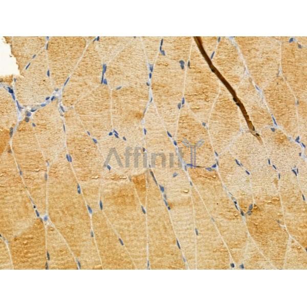 Валидация Affinity DF12178 - 6398