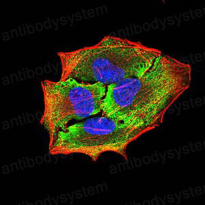 Валидация IF - AntibodySystem RHJ46702