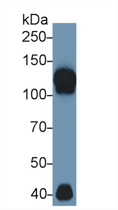 12361