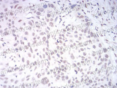 Валидация AntibodySystem RHN94701 (3984)