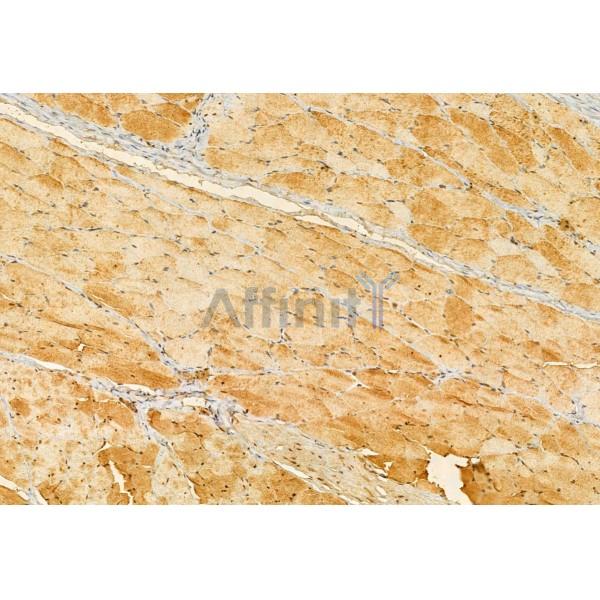 Валидация Affinity DF12034 - 6065