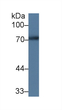 14305