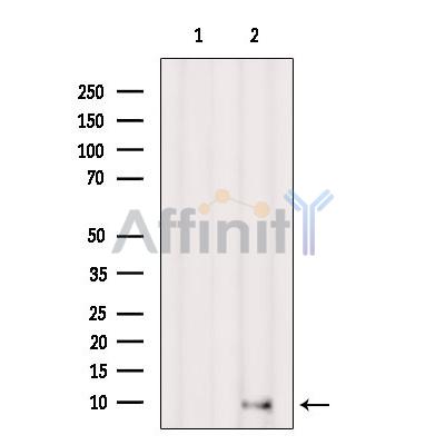 Валидация Affinity DF2394 - 12984