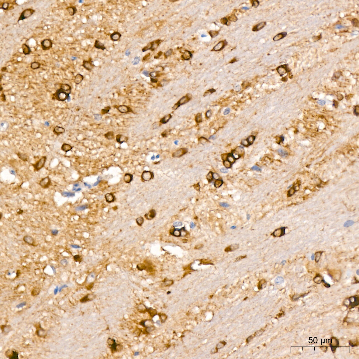 AP1445, иммуногистохимия, ткань мозга крысы (25485)