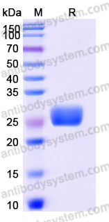 AHJ91702, SDS-PAGE