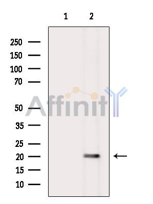 Валидация Affinity DF8621 - 20550