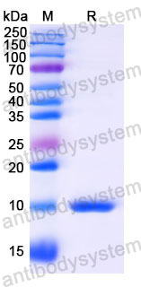 Валидация SDS-PAGE - AntibodySystem RHJ81603