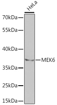 A2575, вестерн-блоттинг, лизат клеток HeLa (3565)