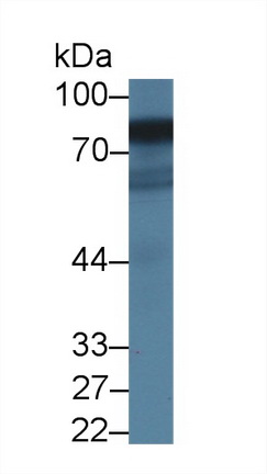 14421