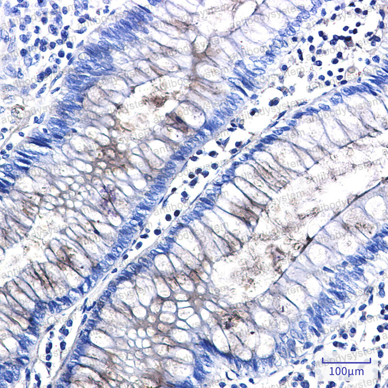 Валидация AntibodySystem RHD04901