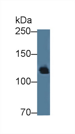 12599