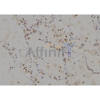 Валидация Affinity DF3875 - 15030