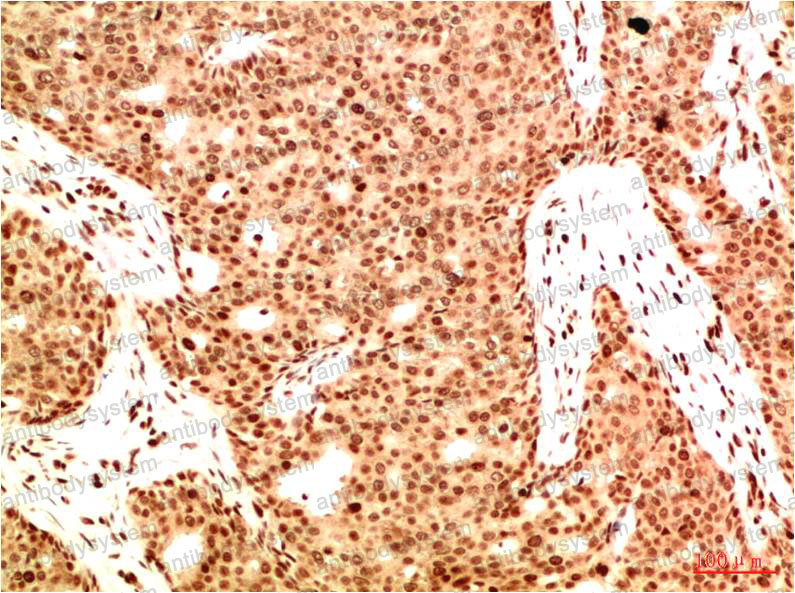 Валидация AntibodySystem RHG01004 (2780)
