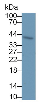 20215