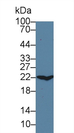 13994