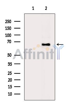 Валидация Affinity AF5134 - 2516