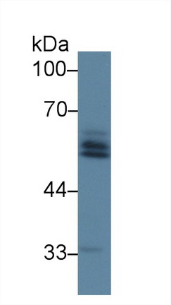 13581
