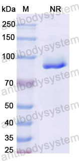 Валидация SDS-PAGE - AntibodySystem RHN07104