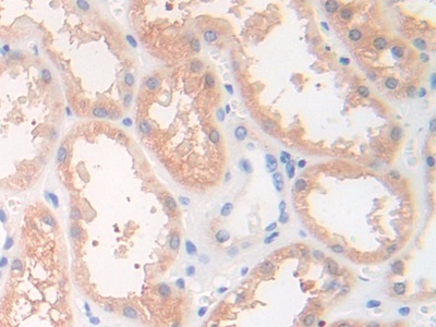 15646