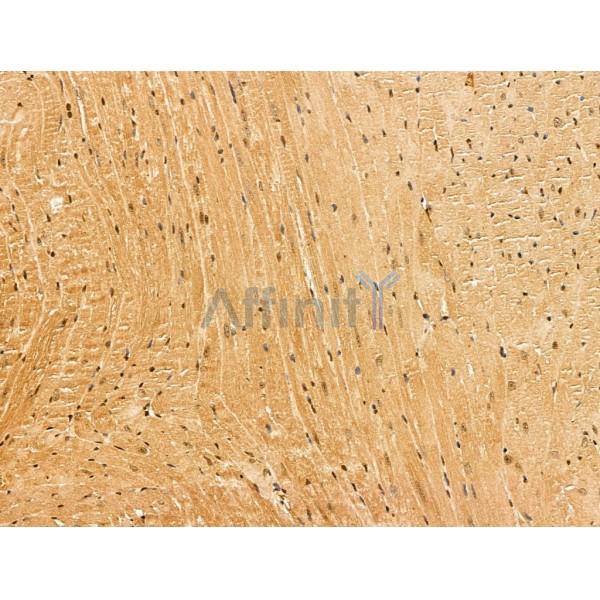 Валидация Affinity DF13170 - 8142