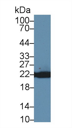 14623
