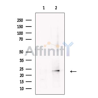 Валидация Affinity DF13481 - 8849
