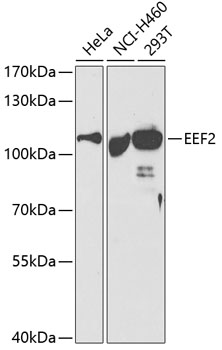 Валидация Elabscience E-AB-60587