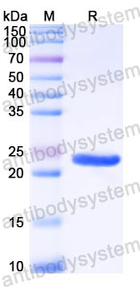 EHC67201, SDS-PAGE