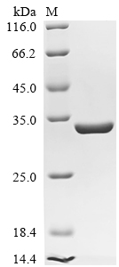 SDS-PAGE
