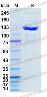 EHD06501, SDS-PAGE