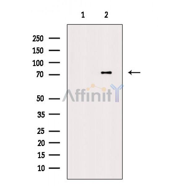 Валидация Affinity AF6576 - 3882