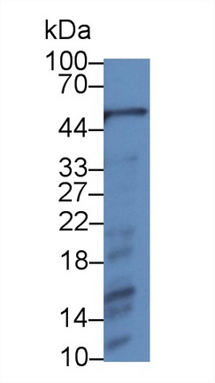 14661