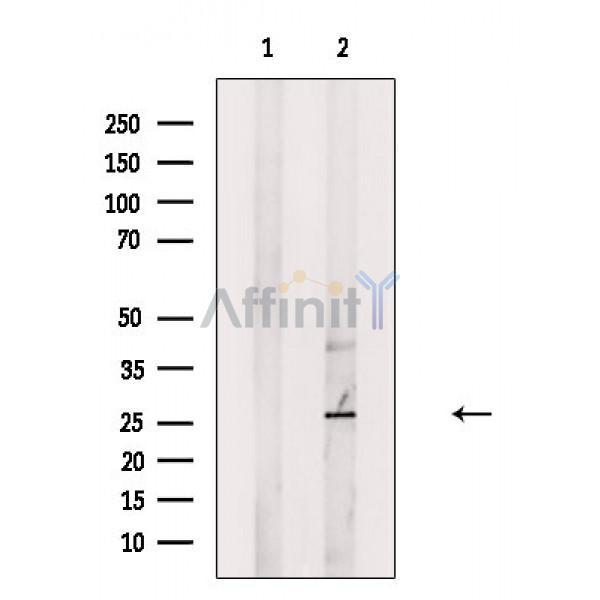 Валидация Affinity DF4118 - 15415