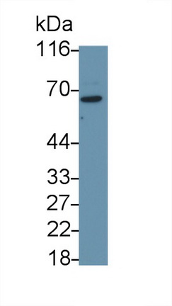 52556