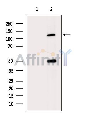 Валидация Affinity DF13893 - 9625