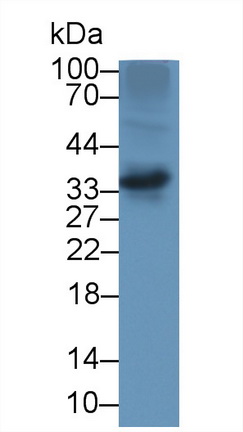 14190