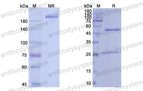 Валидация SDS-PAGE - AntibodySystem DHC09612