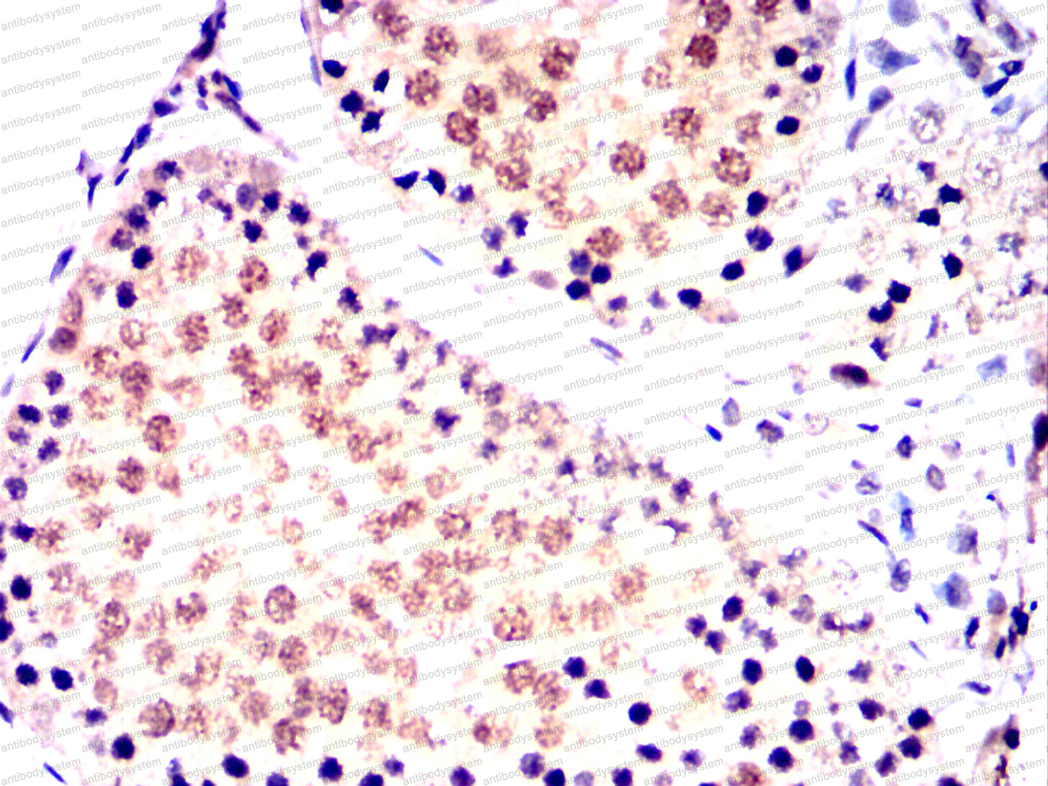 Валидация AntibodySystem RHD99102 (1903)