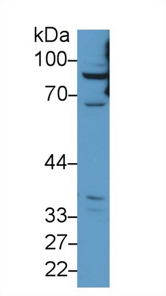 12386